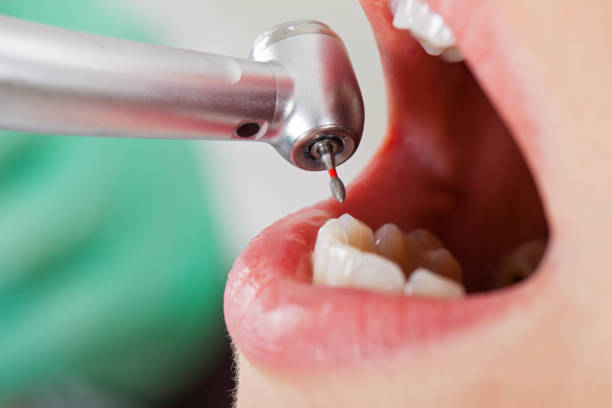 Best Emergency Dental Surgery in Churchill, OH